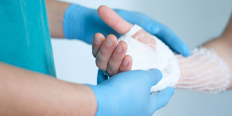 A physician wraps a burn on a patient's hand.